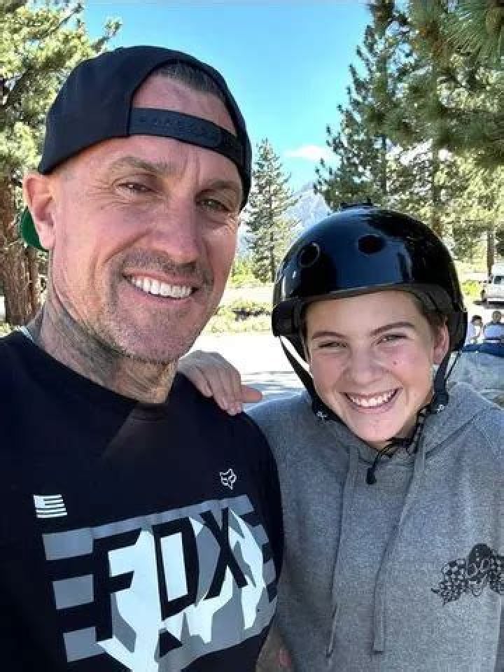Carey Hart