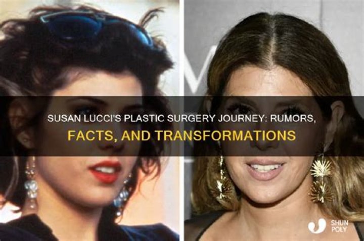 Has Susan Lucci Undergone Plastic Surgery?