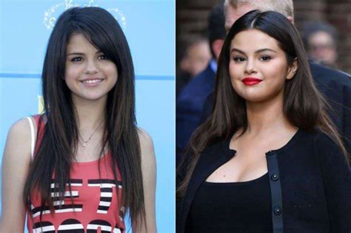 The Evolution of Selena Gomez's Voice and Its Possible Connection to Her Battle with Lupus